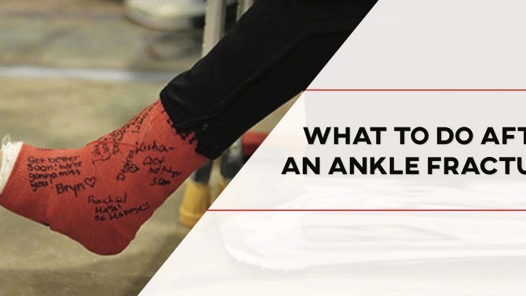 Do I Need Physical Therapy After an Ankle Fracture?